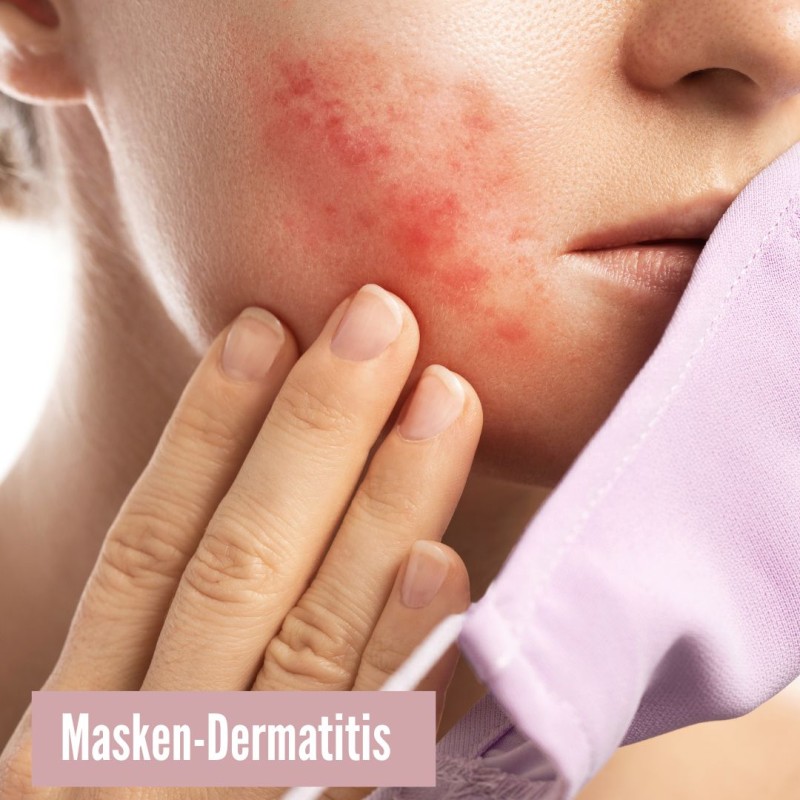 https://www.skinthings.de/media/image/77/e7/13/Masken-Dermatitis.jpg