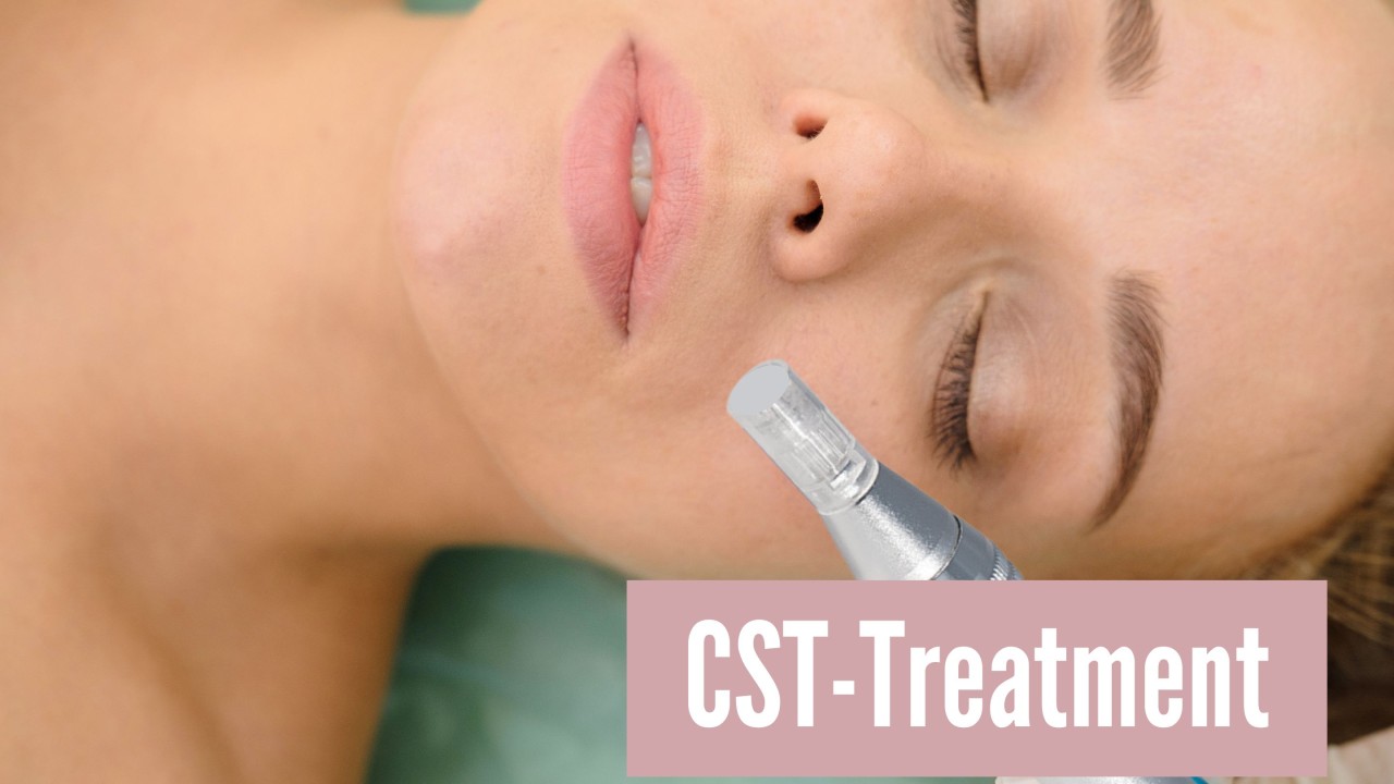 Blogbeitrag-CST-Treatment-2880-x-1620-px